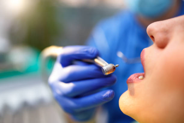 Dental Bonding in Edinboro, PA